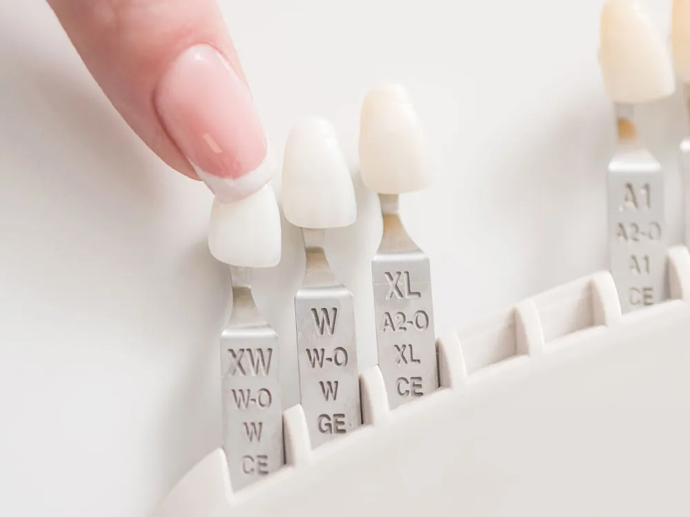 セラミック修復物のイメージ