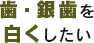 歯・銀歯を白くしたい