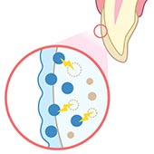 薬剤(過酸化水素)を投与した歯の内部