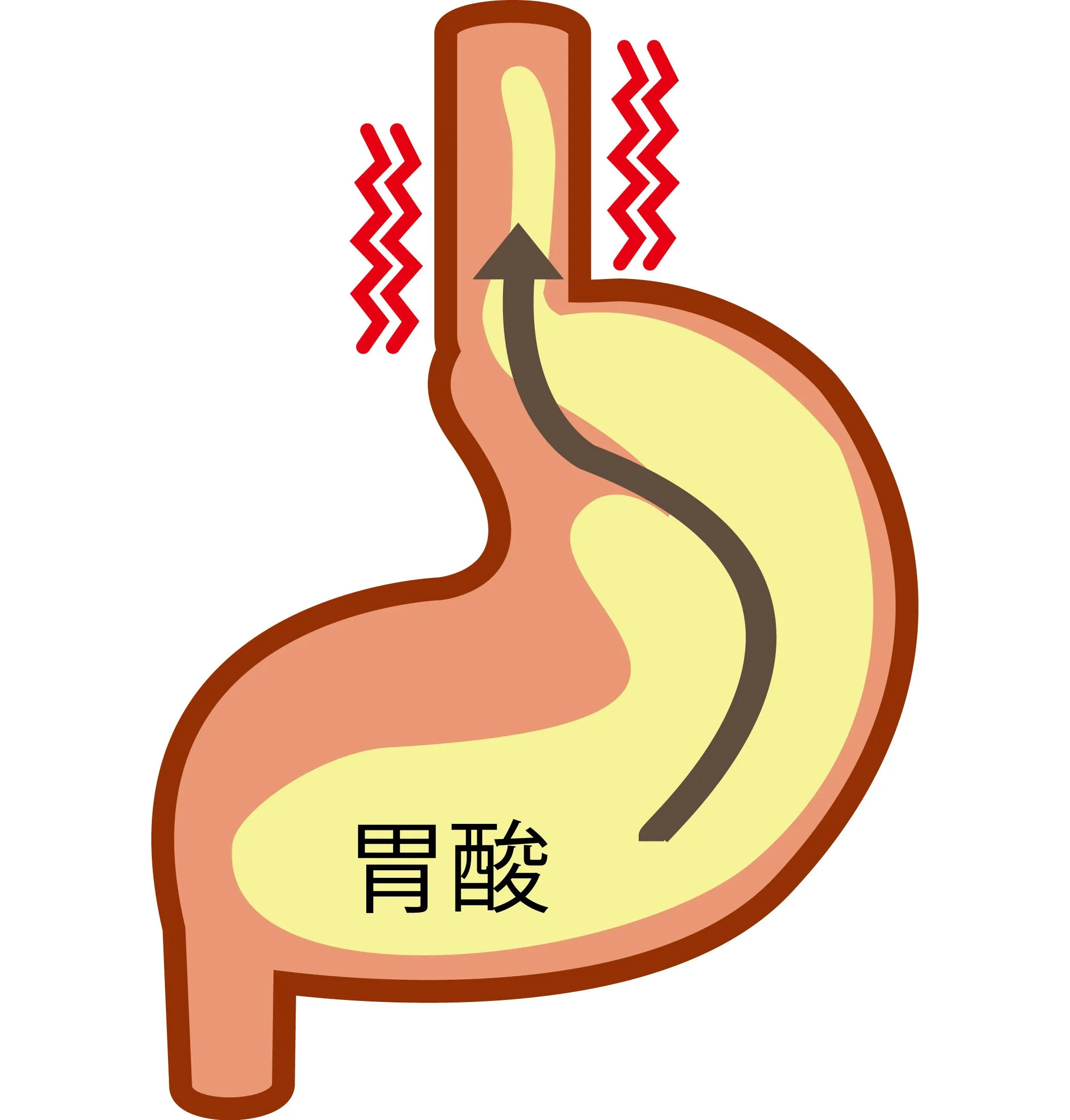 胃酸によるもの