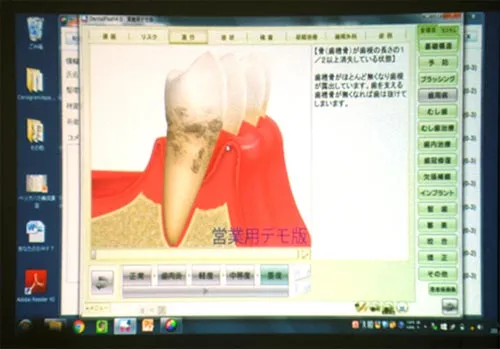 院内セミナーでのスライド