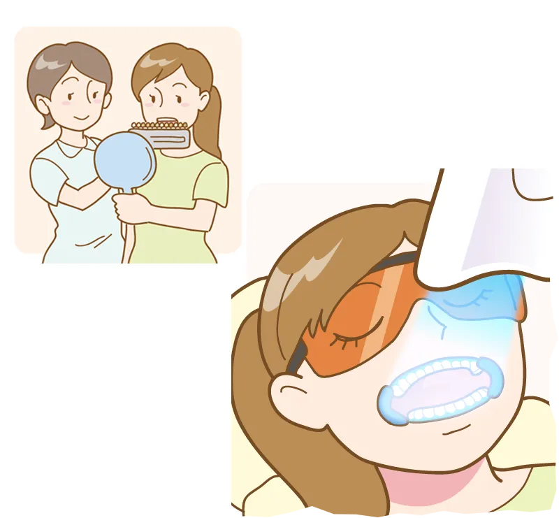 オフィスホワイトニング